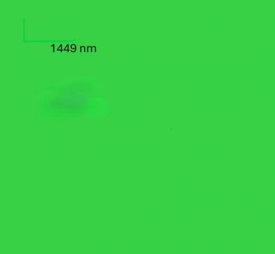 Eladó Telek 1112 Budapest 11. kerület 1112 Budapest 11, Köérberek